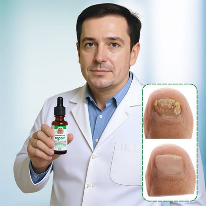 Nails Strong Growth And Repair Oil (Buy 1 Get 1 FREE)