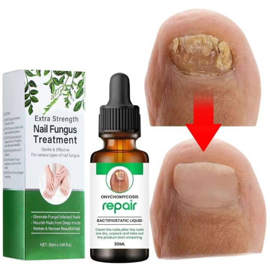 Nails Strong Growth And Repair Oil (Buy 1 Get 1 FREE)